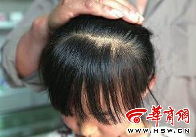 　8歲的嘟嘟在爺爺懷中顯得特別害怕，3個(gè)月前被老師揪掉的頭發(fā)至今沒有長(zhǎng)出 本報(bào)記者 趙釗 攝