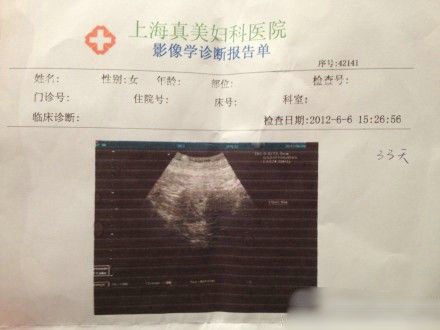 袁莉老公曝妻懷孕一月,曬其B超照。