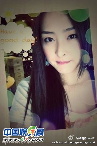 有人爆料指張名雅做過(guò)四次整形手術(shù)，還提供了一張疑似張名雅的舊照(左圖)