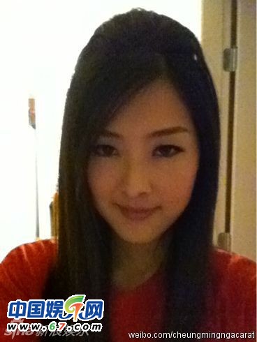 有人爆料指張名雅做過四次整形手術(shù)，還提供了一張疑似張名雅的舊照(左圖)