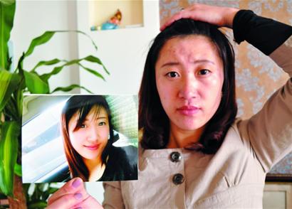 青島女子為聚財(cái)太陽(yáng)穴打萬(wàn)元美容針 流膿浮腫險(xiǎn)毀容
