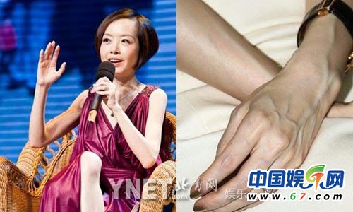 女星排骨盡顯嚇死網(wǎng)友