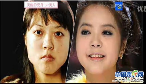 多圖劇透韓國整容節(jié)目《LET 美人》近幾期，最愛小V臉，人瘦就能美