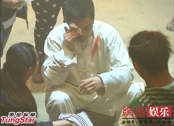 陳奕迅失足摔破睪丸成龍險喪命 盤點(diǎn)明星“悲催”受傷史